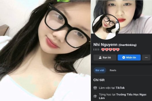 Nhi Nguyễn xinh đẹp đã gặp tai nạn nghiêm trọng